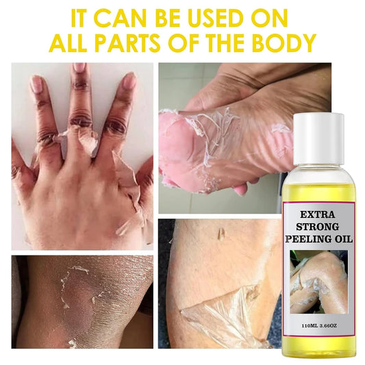 Natural Yellow Peeling Oil