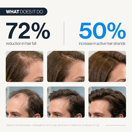 LB | Hair Scalp Roll On Serum