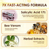 Bee Venom Corn Removal Cream