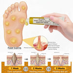 Bee Venom Corn Removal Cream