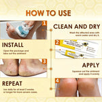 Bee Venom Corn Removal Cream