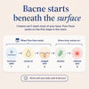Natural Acne Supplement for Clear Skin