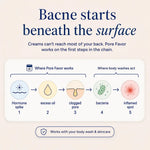 Natural Acne Supplement for Clear Skin