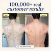 Natural Acne Supplement for Clear Skin