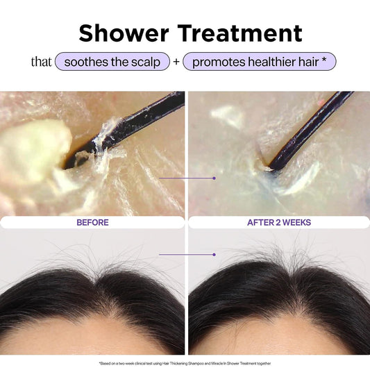 Scalp TreatmentSerum